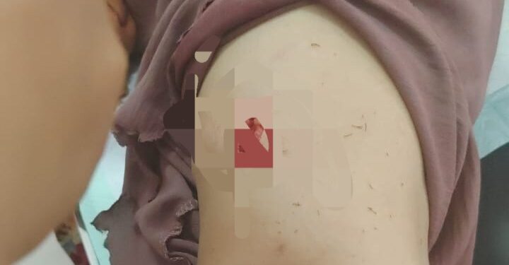 Breaking News! Tak Terima Dicerai, Seorang Suami di Barito Timur Aniaya Istri