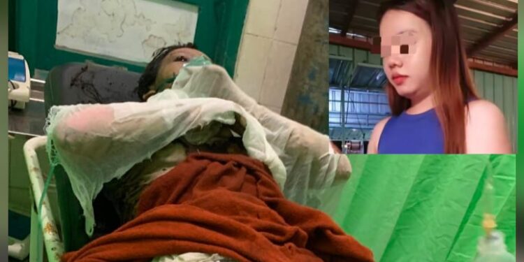 SJ, yang mengalami luka bakar dan inzet foto sebelum kejadian. (Ist)