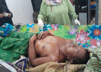 MR (54), warga Jakarta Utara.