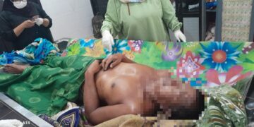 MR (54), warga Jakarta Utara.