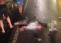 Korban Abdul Ghani (19) yang mengalami luka parah.