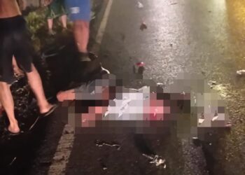Korban Abdul Ghani (19) yang mengalami luka parah.