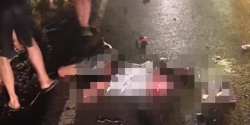 Korban Abdul Ghani (19) yang mengalami luka parah.
