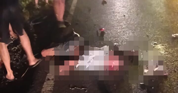 Korban Abdul Ghani (19) yang mengalami luka parah.