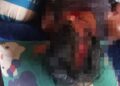Salah satu korban dugaan penganiaan di Kecamatan Sumber Barito, Rabu (30/9/2026). (ist)
