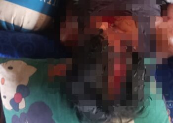 Salah satu korban dugaan penganiaan di Kecamatan Sumber Barito, Rabu (30/9/2026). (ist)