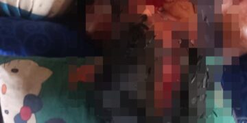 Salah satu korban dugaan penganiaan di Kecamatan Sumber Barito, Rabu (30/9/2026). (ist)